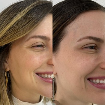 Clínica de Estética Facial em Taboão da Serra