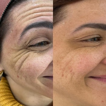 Clínica de Harmonização Facial