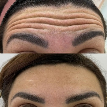 Harmonização Facial Odontológica em Taboão da Serra